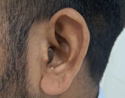 Hearing Aid Repair and Service in Faridabad